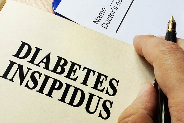 Diabetes insipidus - Causas, sintomas, diagnóstico e tratamento